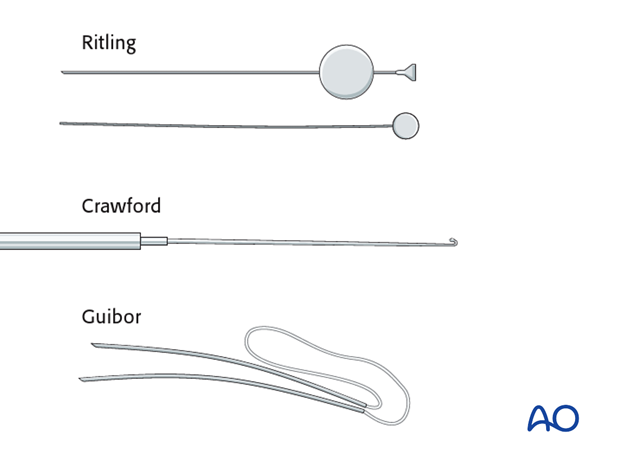 Repair of periorbital soft-tissue injuries and lacrimal system in NOE injuries