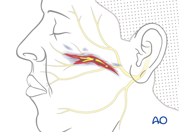 direct nerve repair