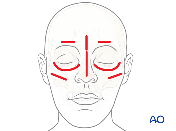 CAS preparation for intraoperative navigation