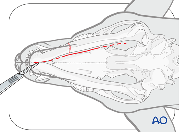 Ventral approach to mandibular body|alt