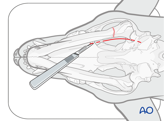 Ventral approach to caudal mandible|alt