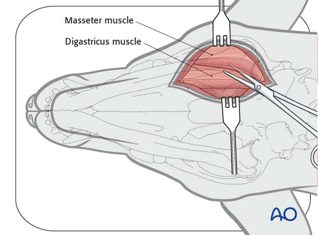 Ventral approach to caudal mandible anatomical exposure digastricus masseter muscle|alt