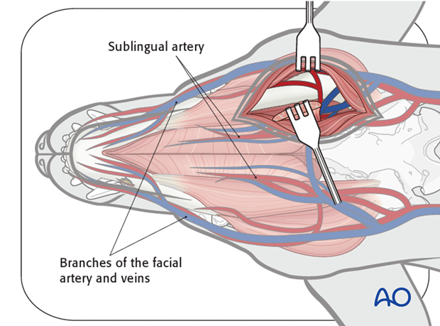 Ventral approach to caudal mandible anatomical structure|alt