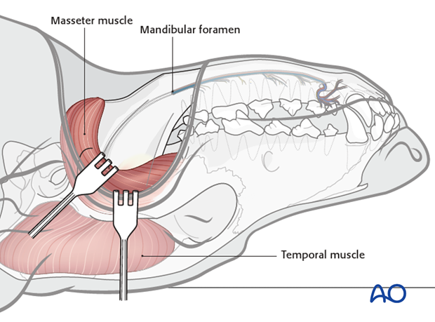 Ventral approach to caudal mandible mandibular foramen protection|alt