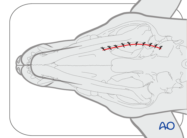 Ventral approach to caudal mandible closure|alt