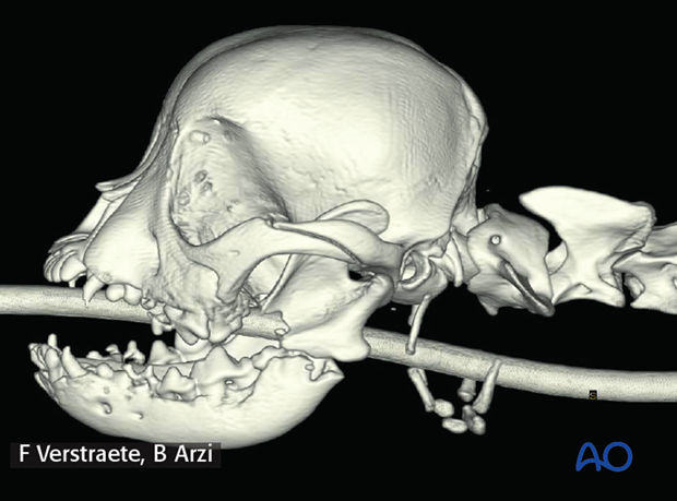 management of fractures in the pediatric patient