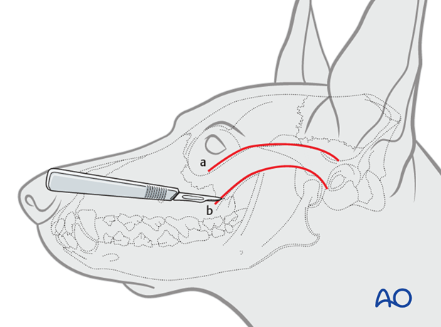 lateral approach to the zygomatic arch