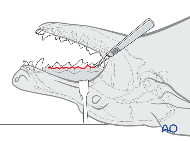 intraoral approach to the maxilla