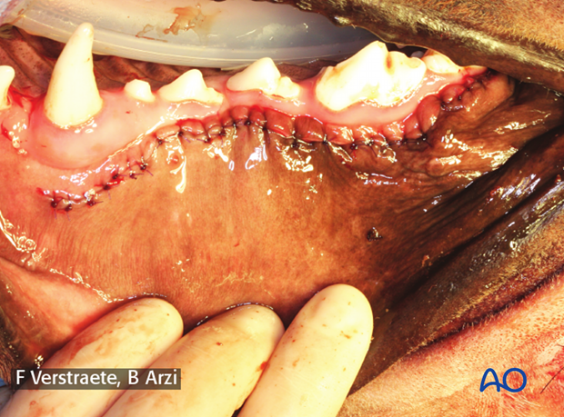 intraoral approach to the maxilla