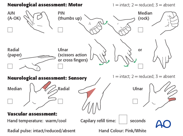 anterior approach