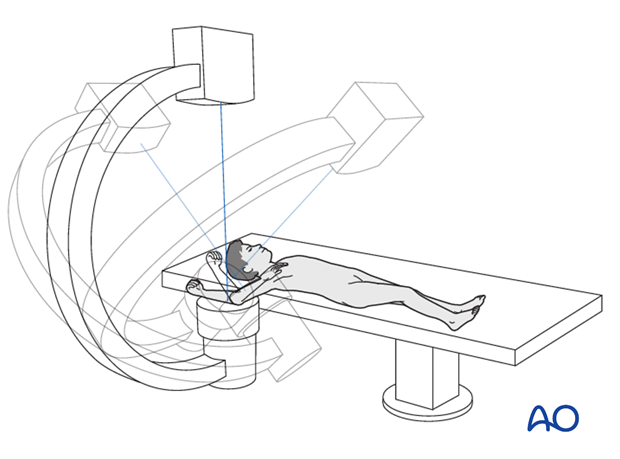 supine position