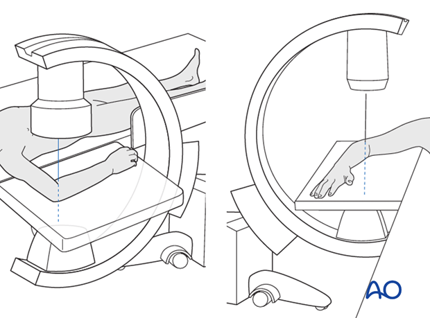 Supine position - C-arm positioning