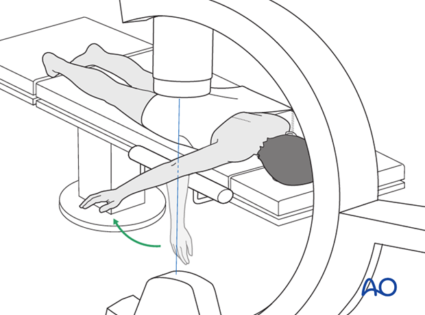 Prone position - C-arm positioning