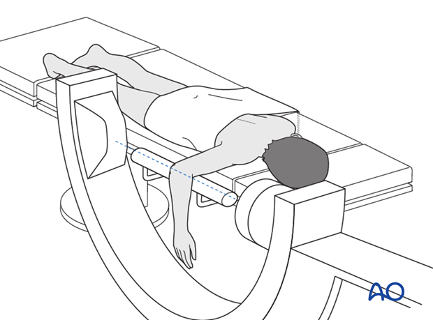 Prone position - C-arm positioning