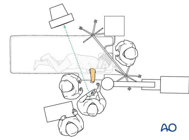 Lateral position - OR set-up