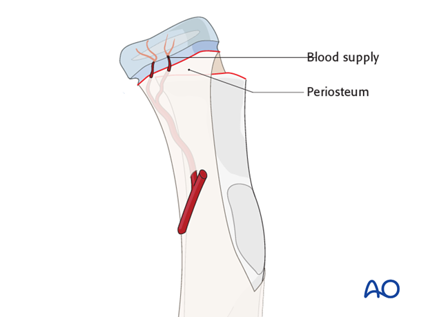 complications of radial head and neck fractures