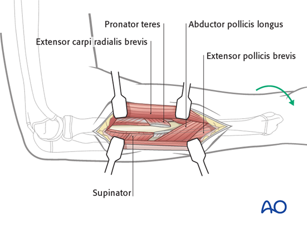 Rotation of the forearm