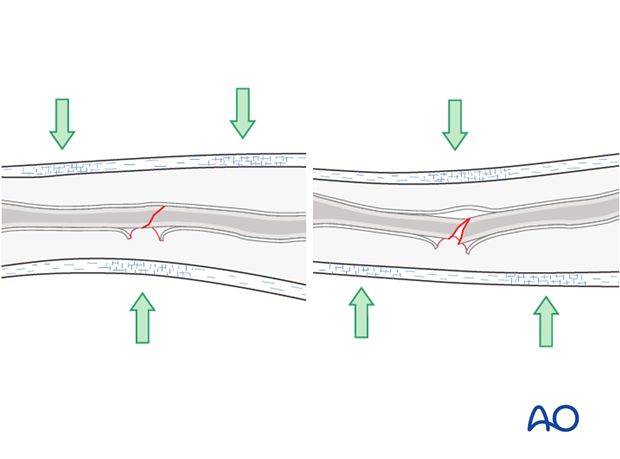 forearm surface anatomy