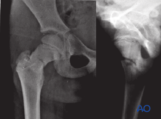 radiological assessment