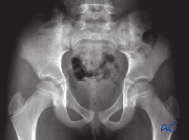 radiological assessment