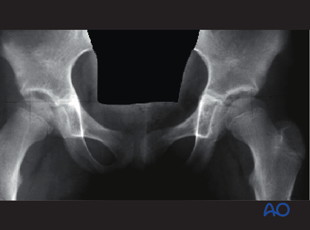 radiological assessment