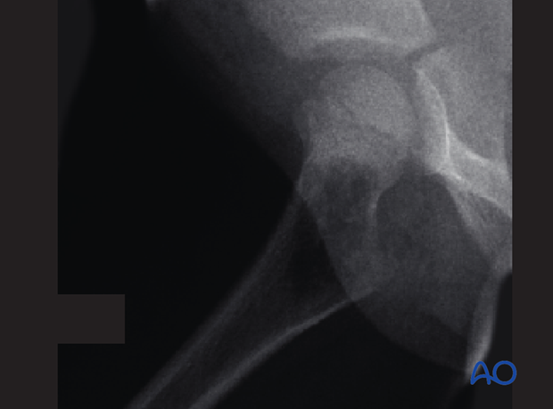 radiological assessment