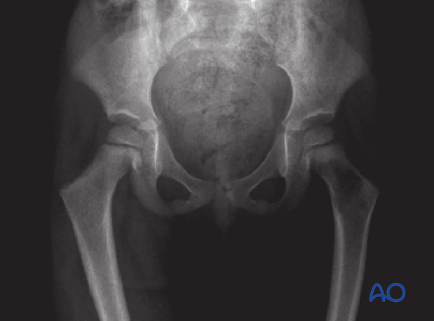 radiological assessment