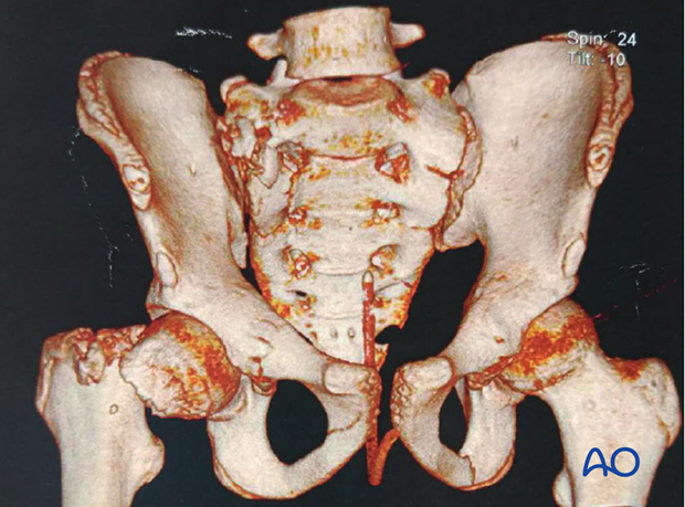 radiological assessment