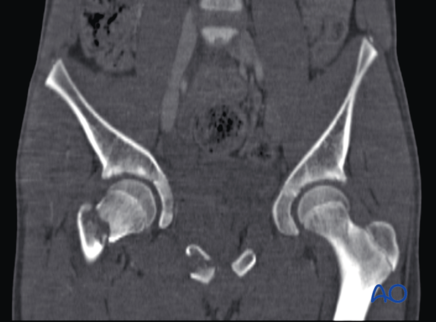 radiological assessment