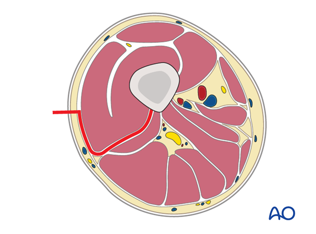 Cross-section of the thigh