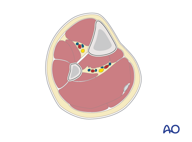 Cross-section of the pediatric tibia