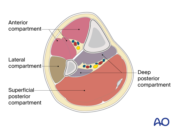 Cross-section of the pediatric tibia - The lower leg has four compartments