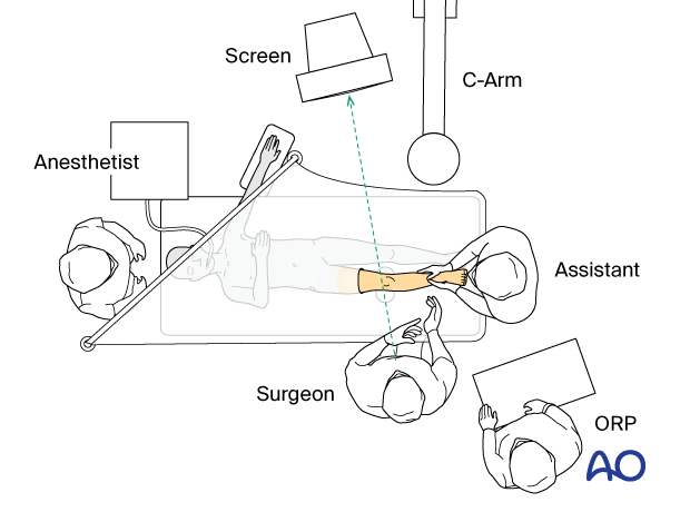 Supine position of a pediatric patient for surgery of the tibial shaft - OR set-up