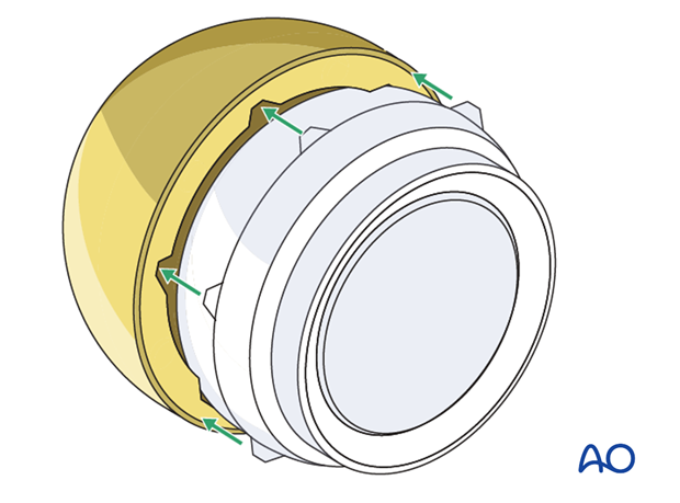 Coupling with primary acetabular cup