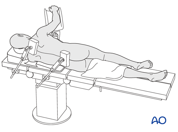 Pr130 Lateral position