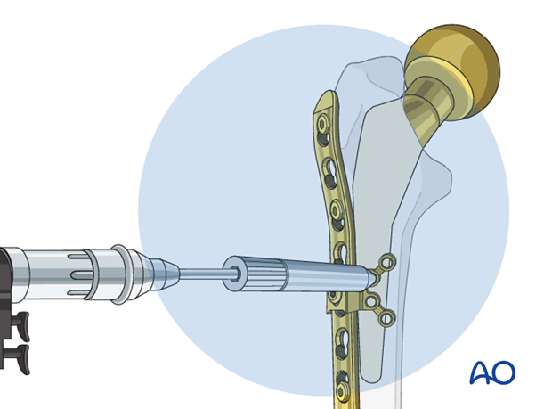 A screw hole is drilled with a drill bit