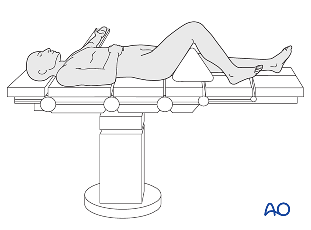 Supine position knee flexed 90 degrees