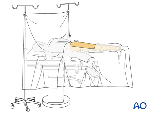 Pr130 Lateral position