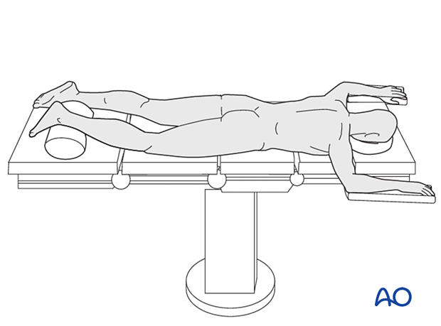 Pr140 Prone position